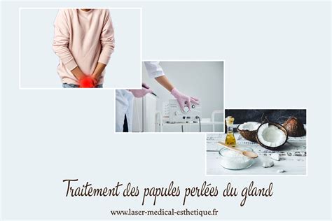 papule perlée|Traitement de la couronne perlée du gland 